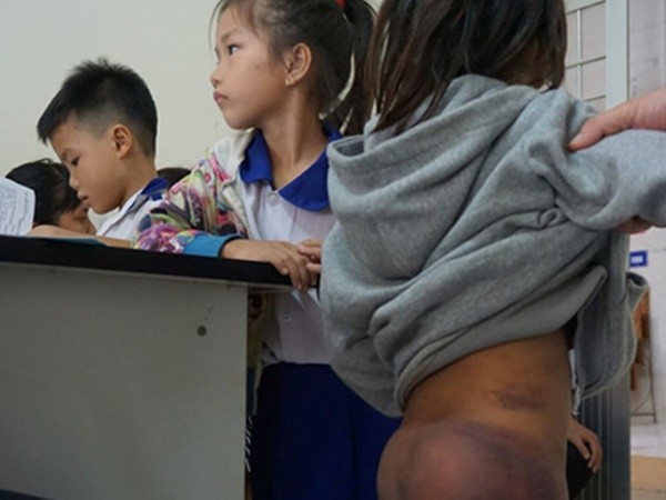 4 học sinh bị bạo hành ở Cà Mau: Ông nội và hai chị họ đánh